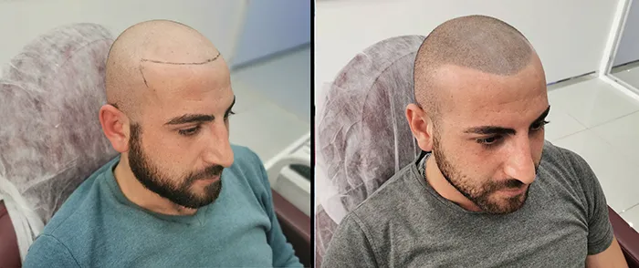 Saç simülasyonu